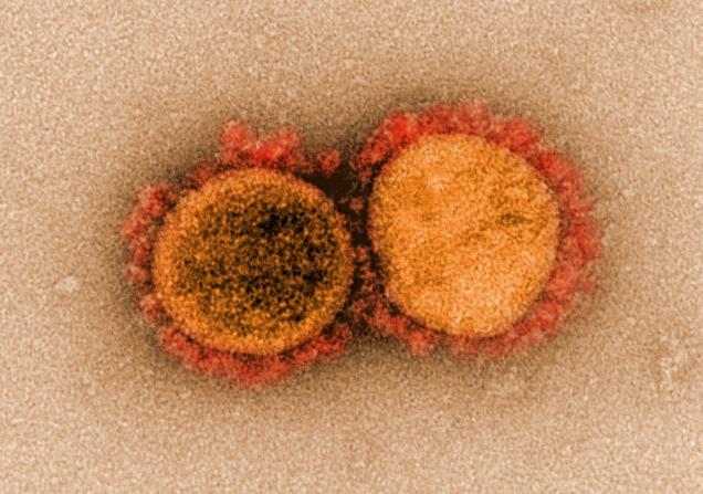 Transmission electron micrograph of SARS-CoV-2 virus particles. Image by National Institute of Allergy and Infectious Diseases, NIH