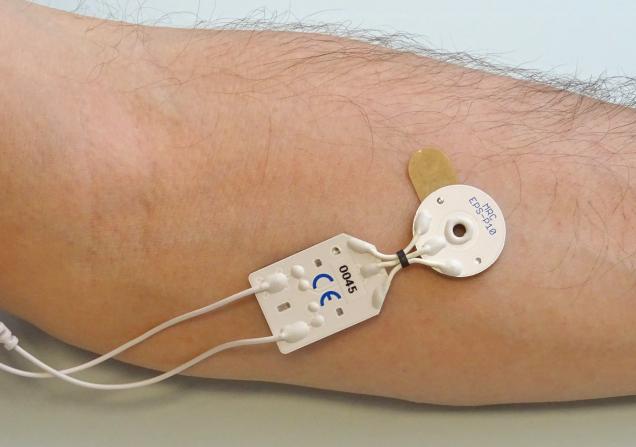 A white electrode is attached to the inside of a person's forearm. There are two white wires coming out of the device. Image credit: Jan Niclas Hoeink, MRC Systems GmbH