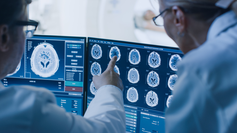 Researchers looking at a brain scan. Image credit: Gorondkoff via Shutterstock.